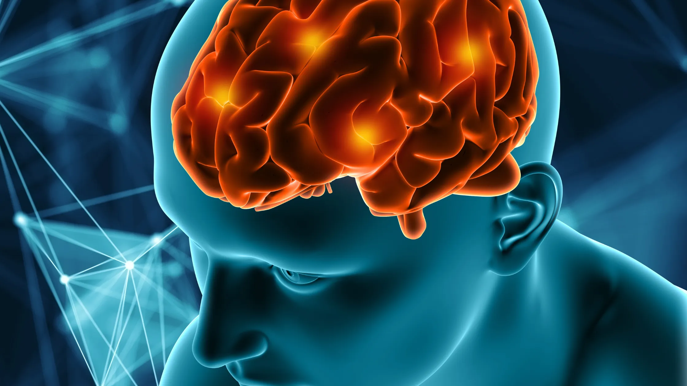 Medical illustration 4 - Why Every Second Counts in Stroke Treatment at Bellaire ER