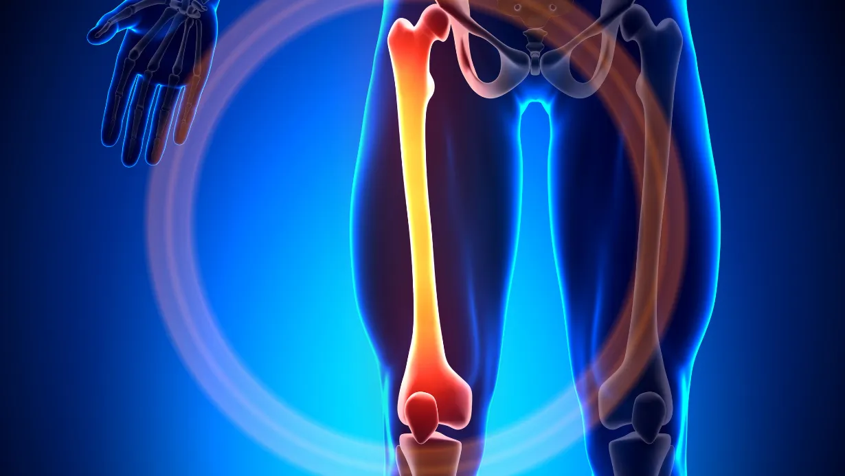 Medical illustration 2 - What to Do If You Suspect a Broken Bone