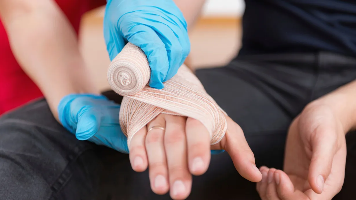 Medical illustration 2 - First Aid Essentials: How to Treat a Burn at Home