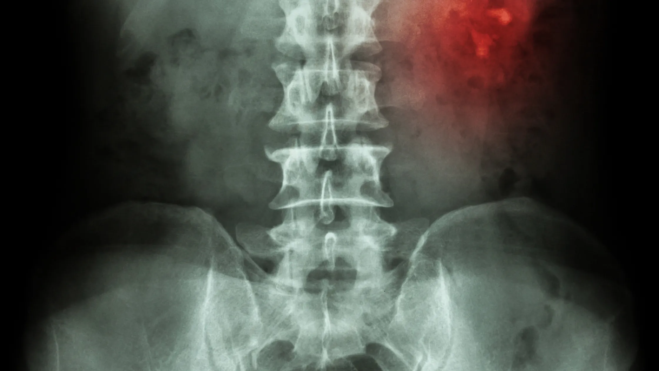 Illustration for Bellaire ER: Expert Kidney Stone Treatment | Urgent Care in Texas
