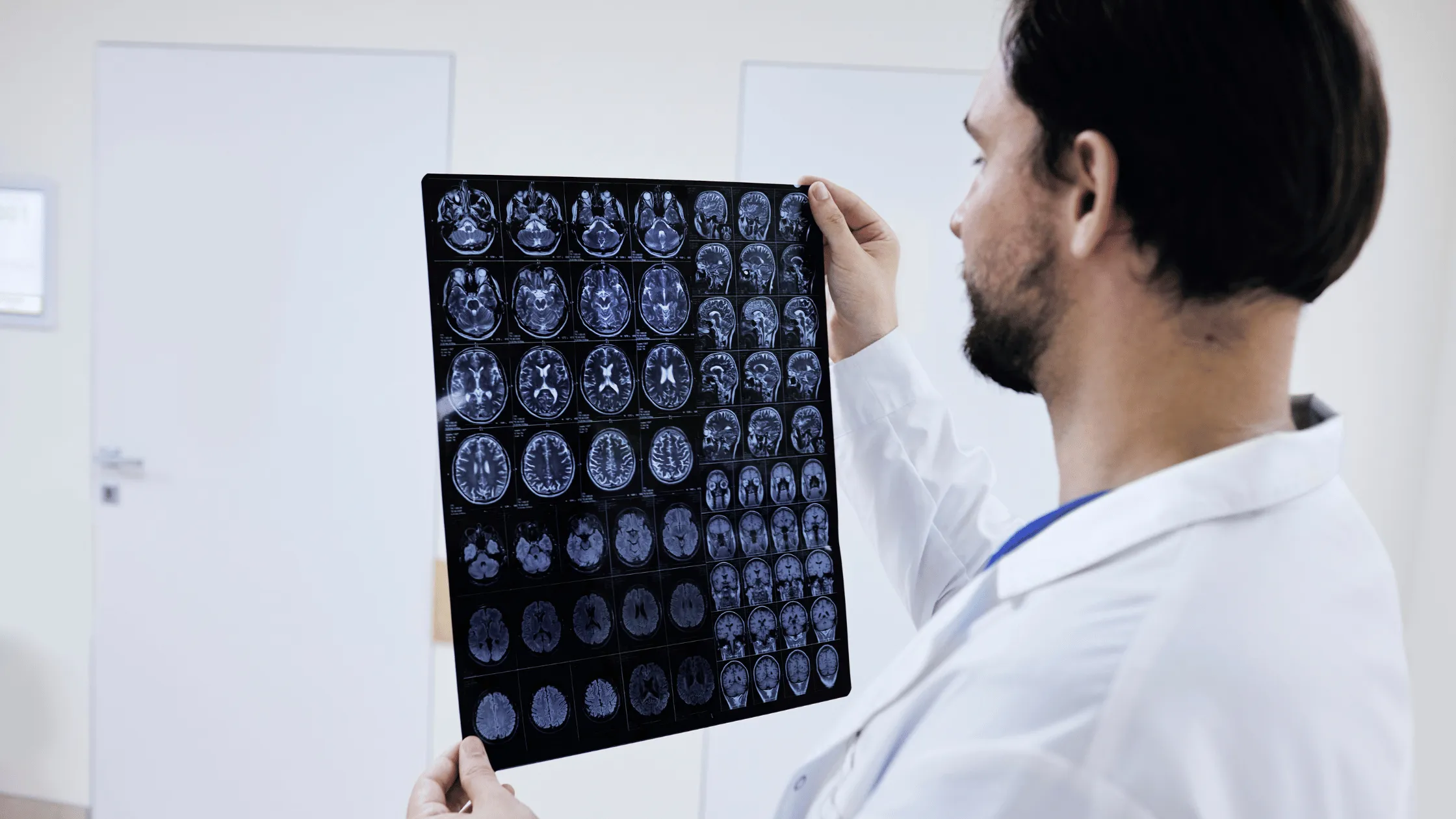 Illustration for Understanding Seizures: Causes, Types, and Treatment for Effective Care | Bellaire ER