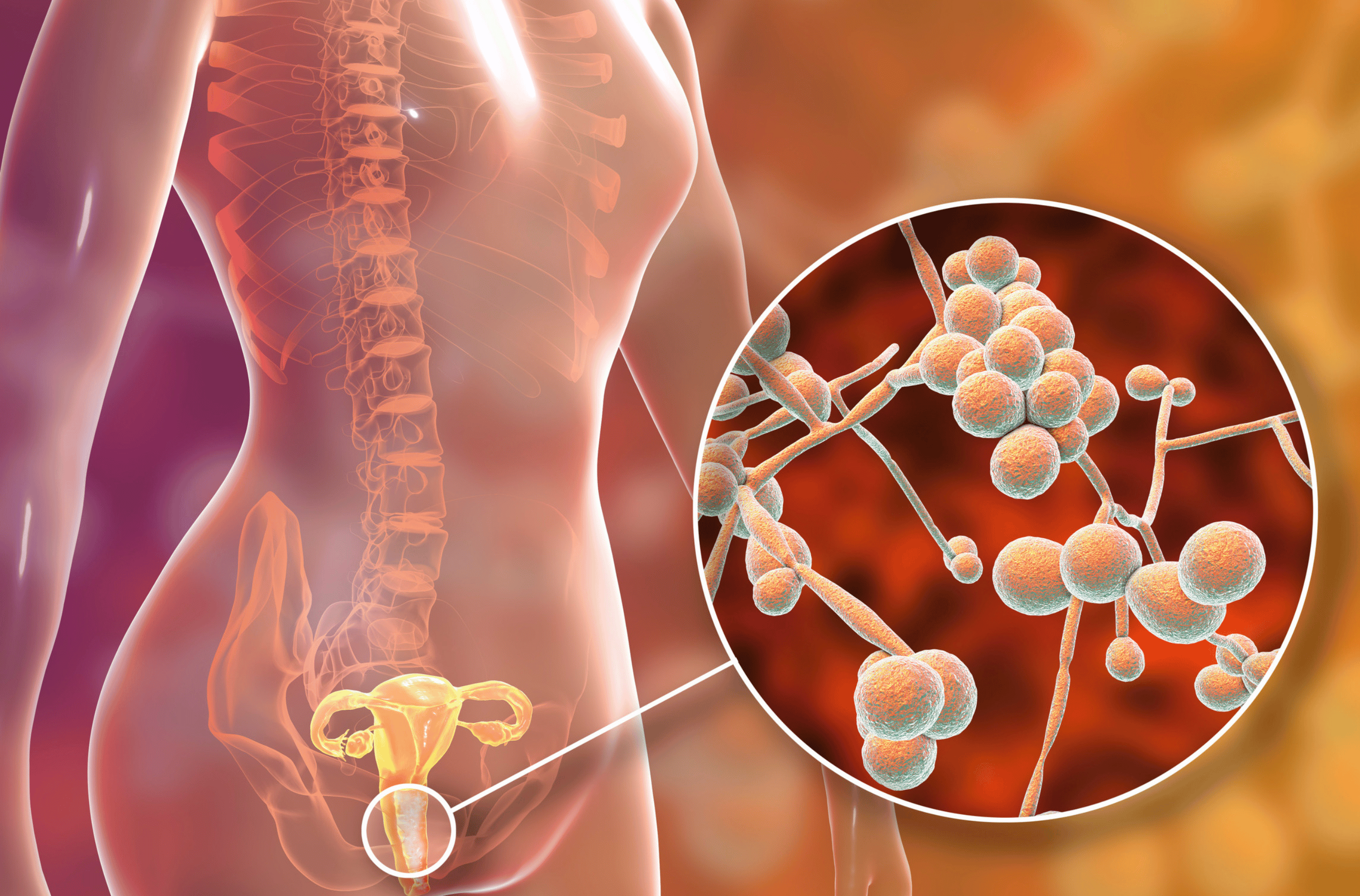 Medical illustration 2 - Battling Fungal Infections: From Causes to Natural Cures at Bellaire ER