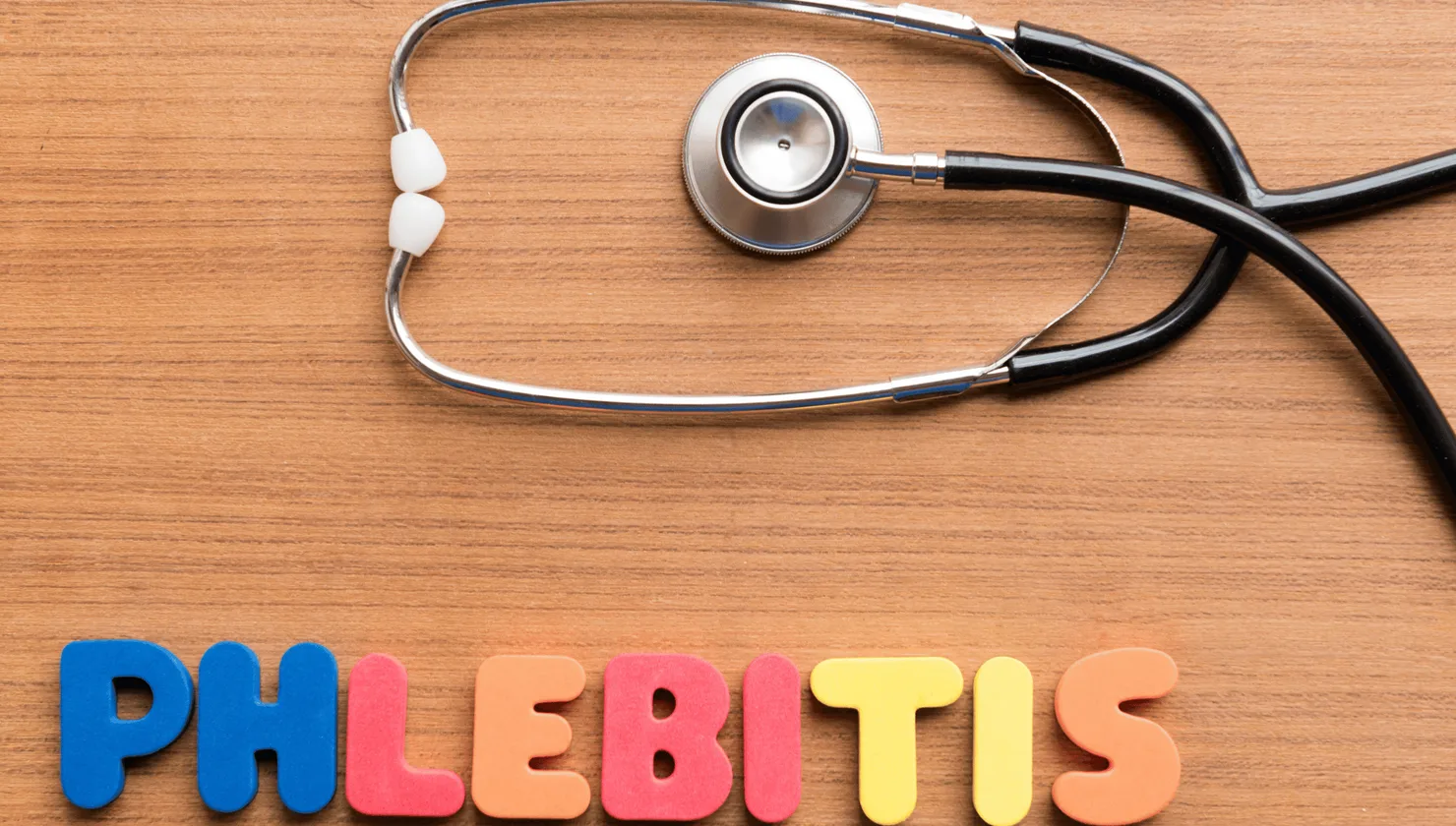 Illustration for Phlebitis treatment at Bellaire ER