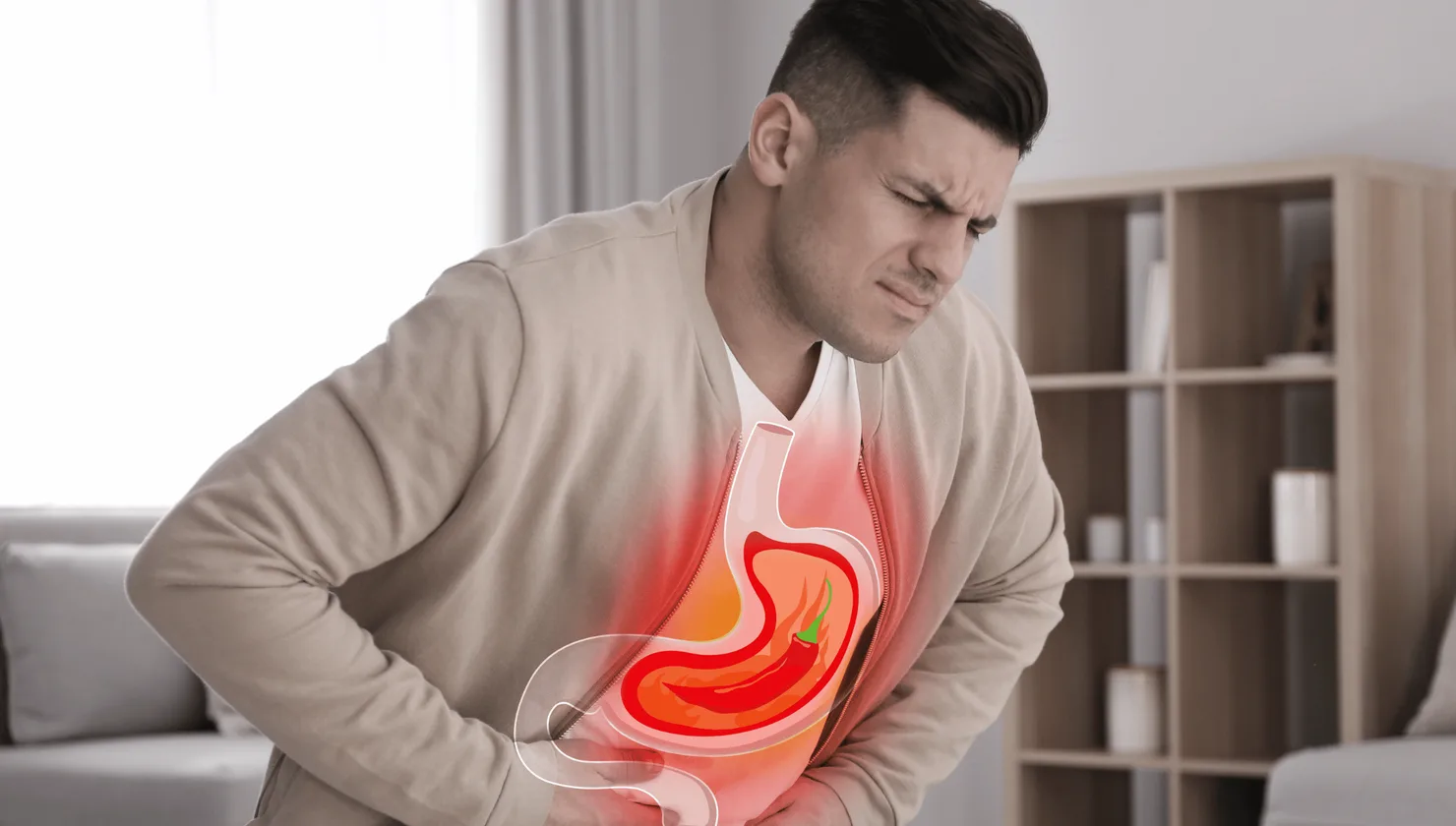 Illustration for Heartburn treatment at Bellaire ER