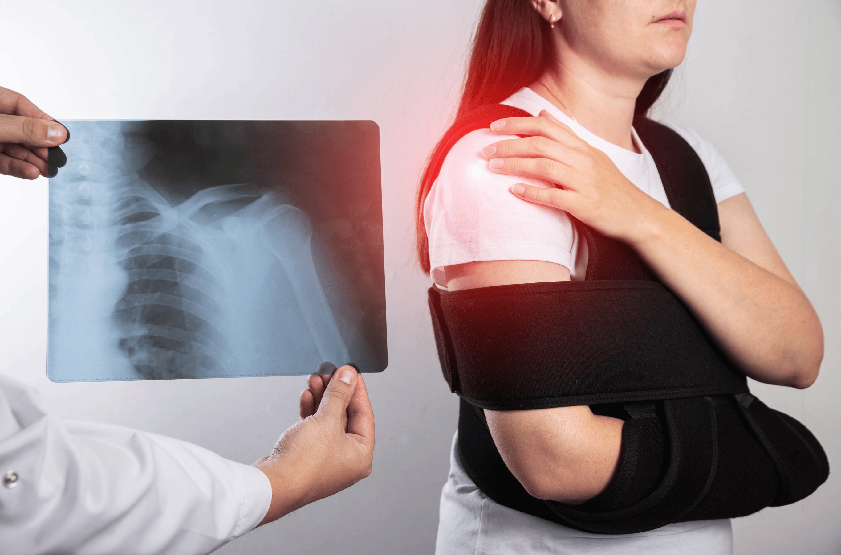 Illustration for Dislocations treatment at Bellaire ER